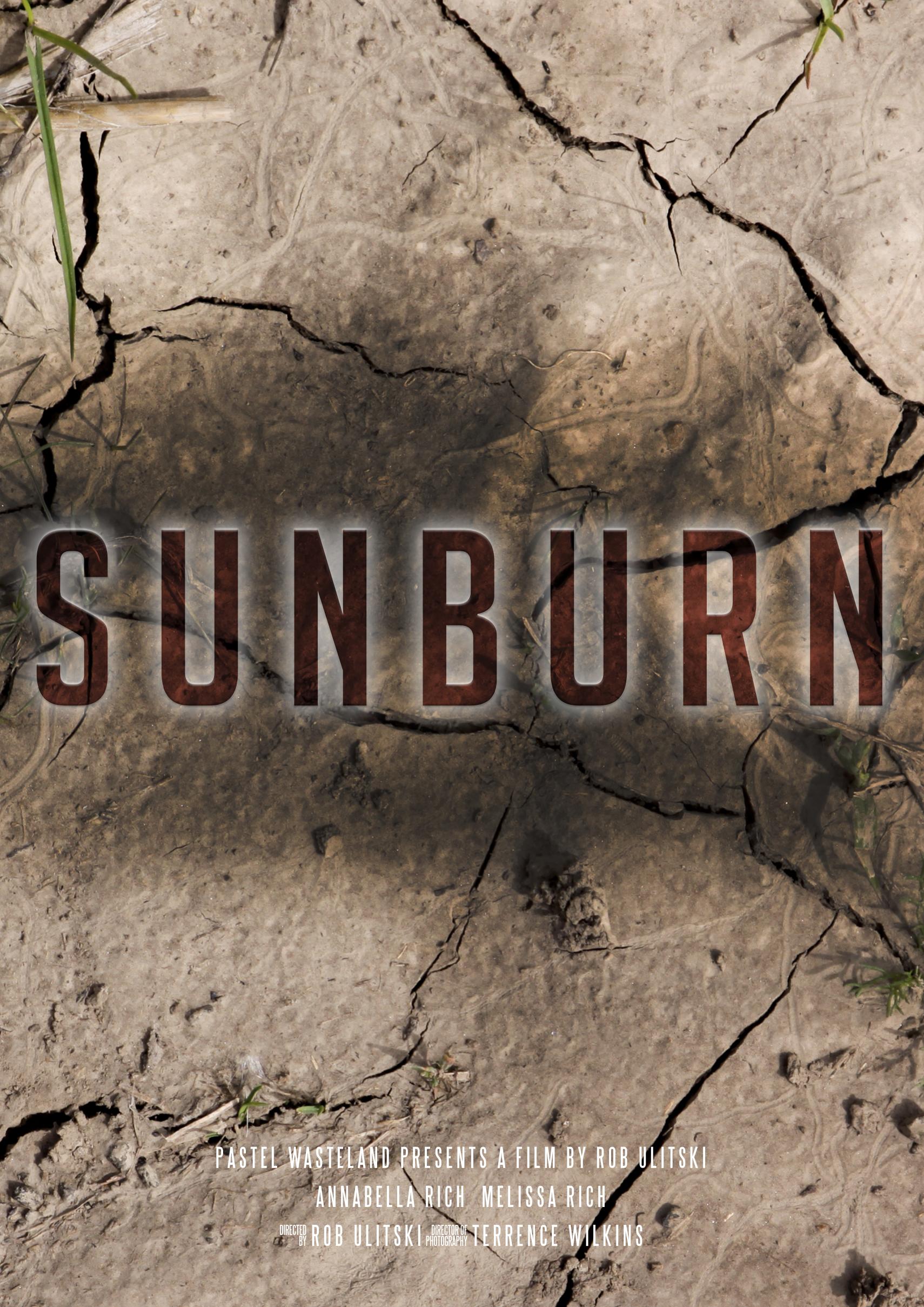Sunburn